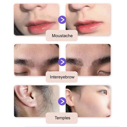 💗Last Day Special Price £2.8🔥Buy 3 Get 2 Free（5pcs）🔥Gentle and Painless Facial Hair Removal Cream